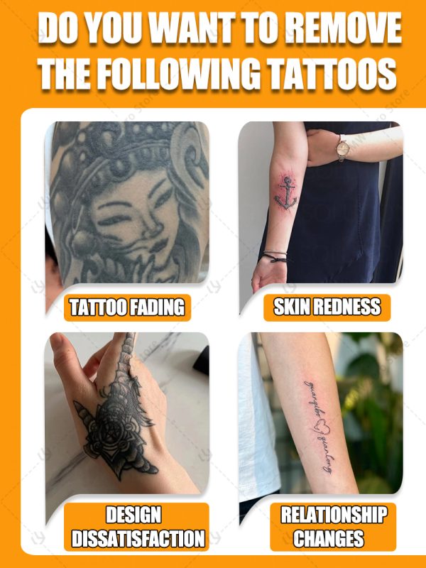 old permanent tattoo removal - Image 2