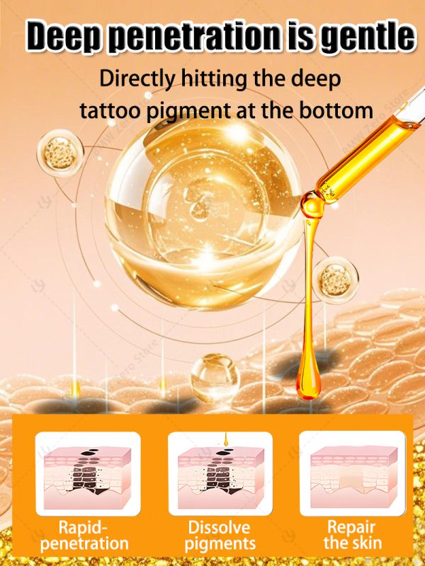 old permanent tattoo removal - Image 5