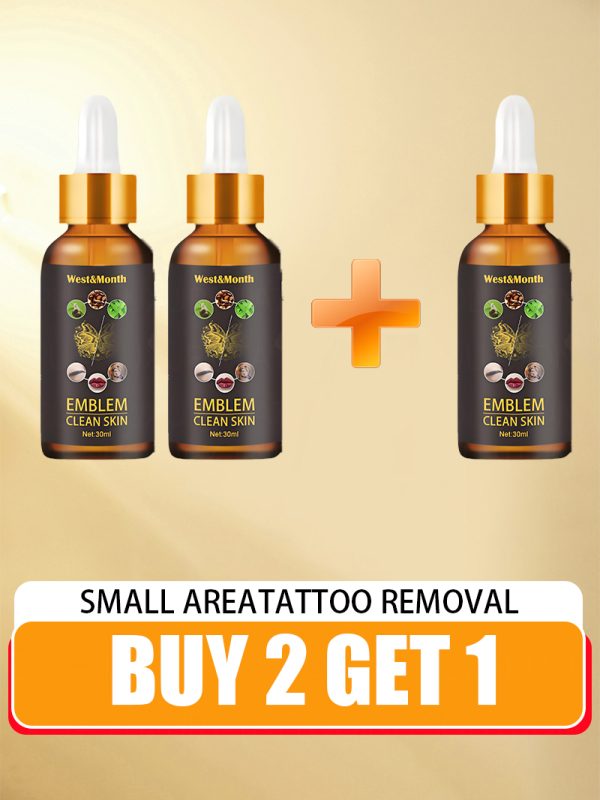 old permanent tattoo removal - Image 7