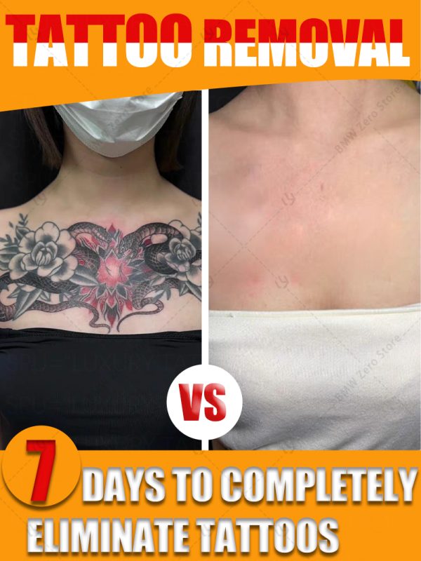 old permanent tattoo removal