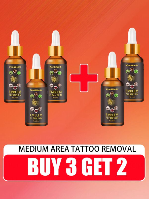 old permanent tattoo removal - Image 8